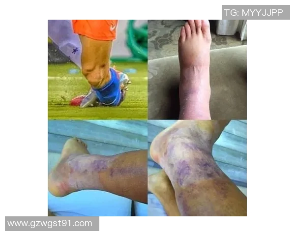 足球明星因伤接受手术重返赛场的励志故事与康复历程揭秘